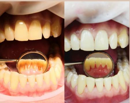 Фотография Стоматологическая клиника доктора Дышекова 4