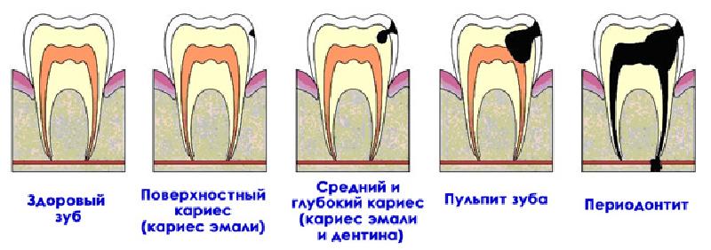 1d5fcf95449ab155adf0ac06fbe1a383.jpg