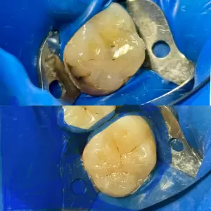 Фотография Adental clinic 4