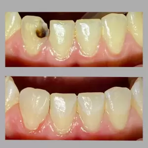 Фотография Adental clinic 5